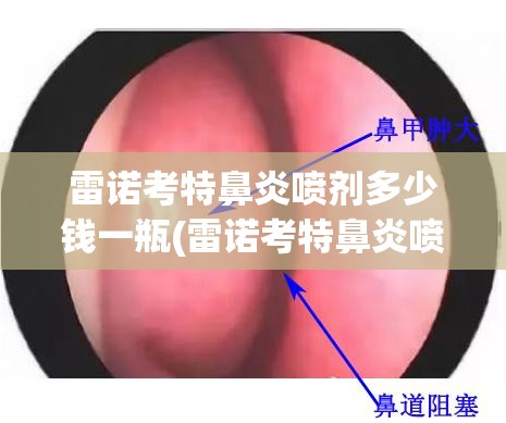 雷诺考特鼻炎喷剂多少钱一瓶(雷诺考特鼻炎喷剂用多久)